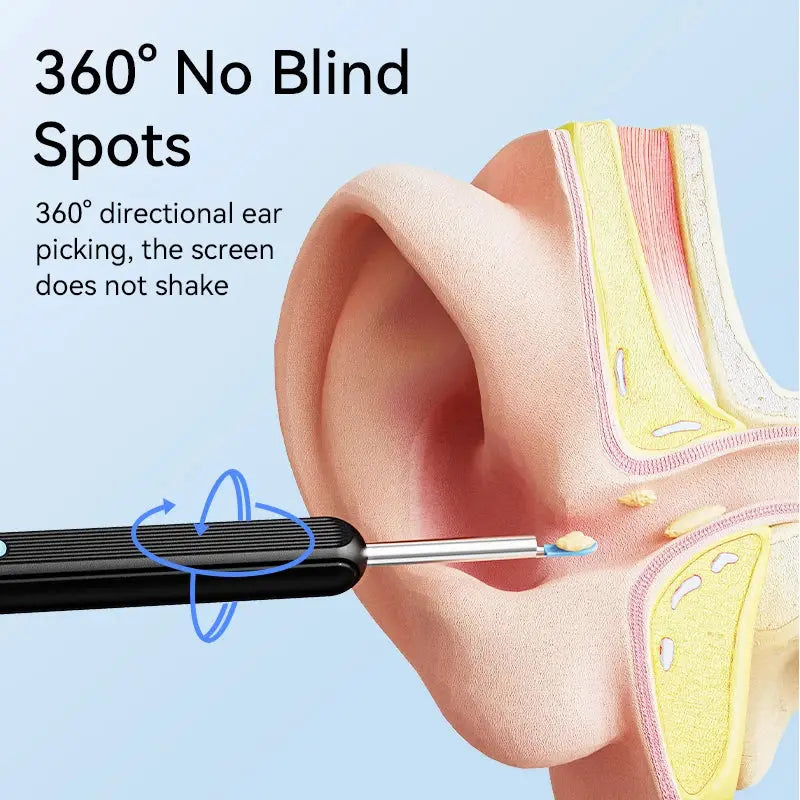 Wireless Ear Wax Removal Tool Camera – LED Light & Smart Cleaning Kit Babarify