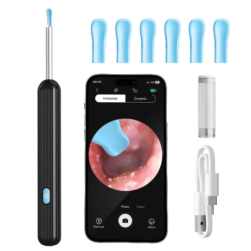Wireless Ear Wax Removal Tool Camera – LED Light & Smart Cleaning Kit - Babarify black
