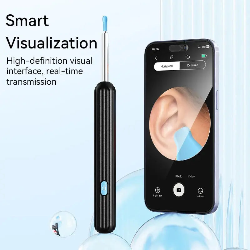 Wireless Ear Wax Removal Tool Camera – LED Light & Smart Cleaning Kit Babarify